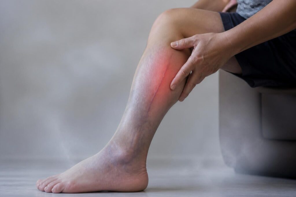 découvrez les symptômes clés d'une artère de la jambe bouchée et les signes à surveiller pour agir rapidement et prévenir les complications.